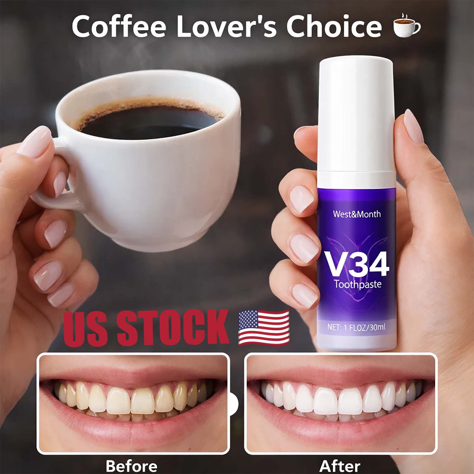 Teeth Whitening Crest - V34 Teeth Whitening Mousse, Purple Color