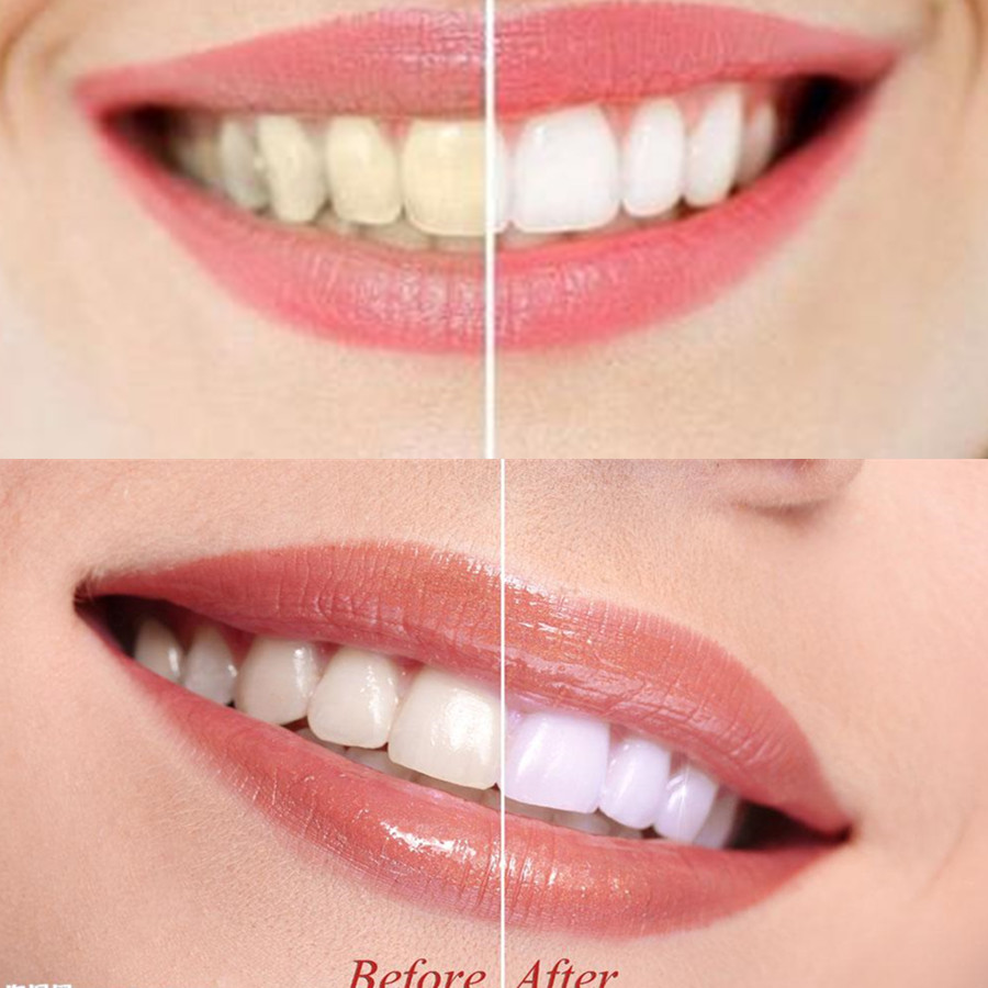 Bamboo Charcoal Teeth Tooth De - Teeth Whitening Ingredients recensie en prijs