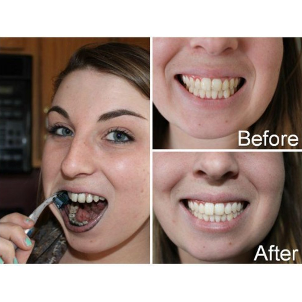 Bamboo Charcoal Teeth Tooth De - Teeth Whitening Ingredients recensie en prijs