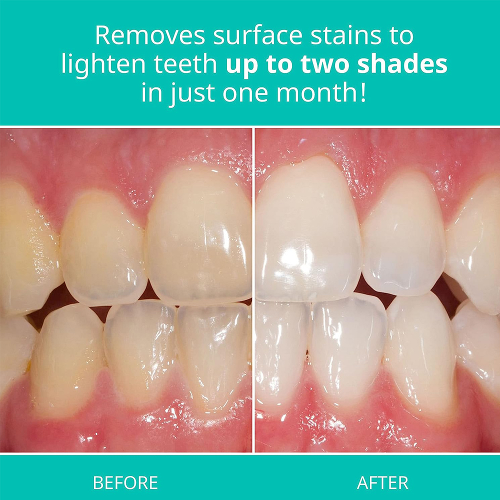 Opalescence Whitening Toothpas - Teeth Whitening Opalescence recensie en prijs