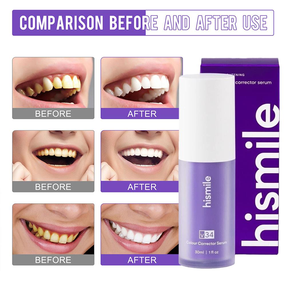 30ml Hismile V34 Purple Teeth  - Teeth Whitening Crest recensie en prijs