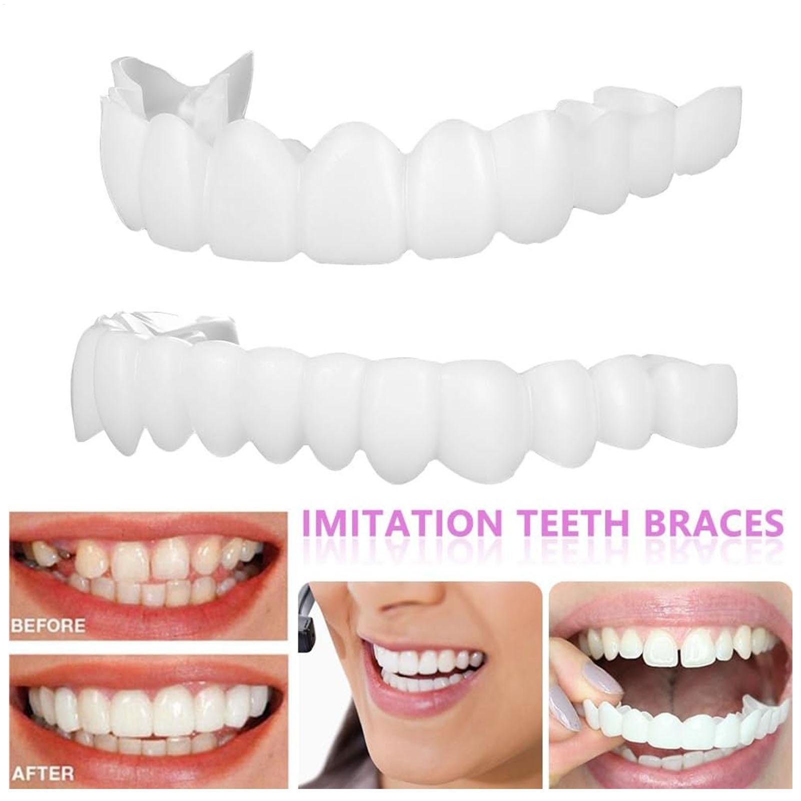 Dental Upper Lower Fake Teeth  - Teeth Whitening In Office recensie en prijs