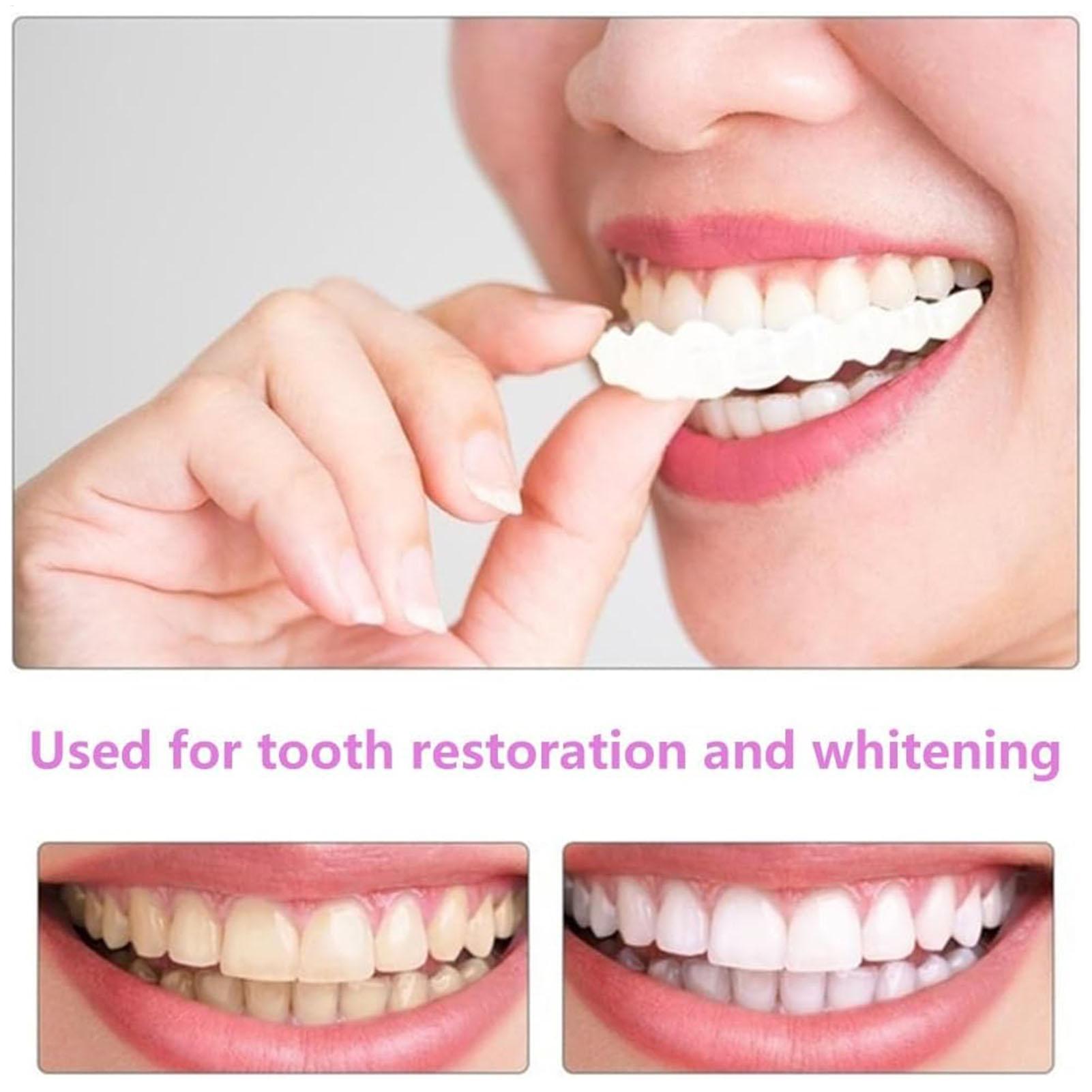 Dental Upper Lower Fake Teeth  - Teeth Whitening In Office recensie en prijs