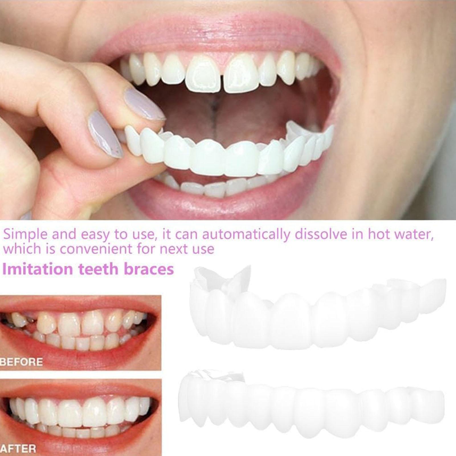 Dental Upper Lower Fake Teeth  - Teeth Whitening In Office recensie en prijs