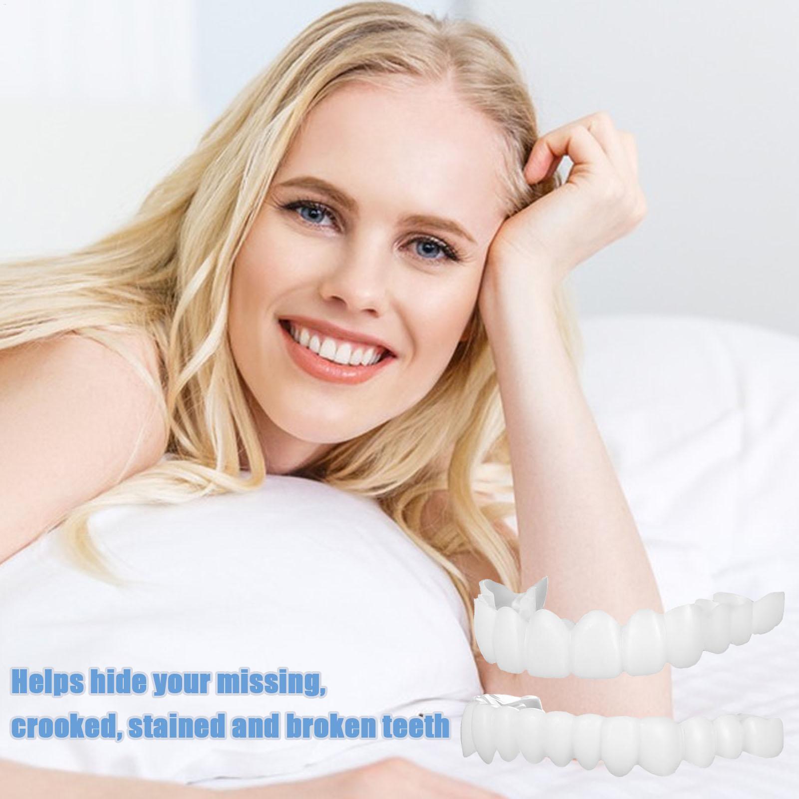 Dental Upper Lower Fake Teeth  - Teeth Whitening In Office recensie en prijs