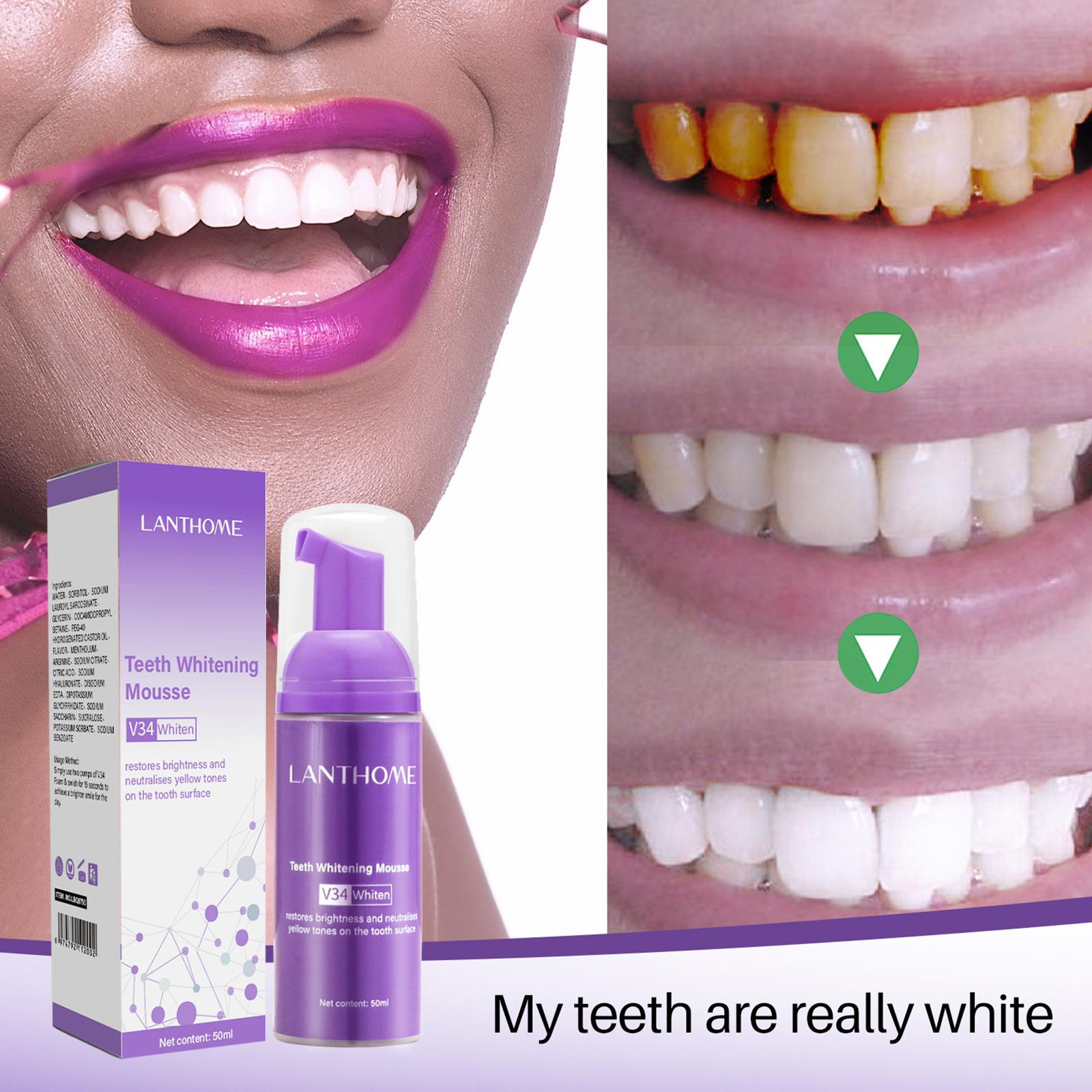 V34 Mousse Teeth Cleaning Toot - Teeth Whitening Crest recensie en prijs