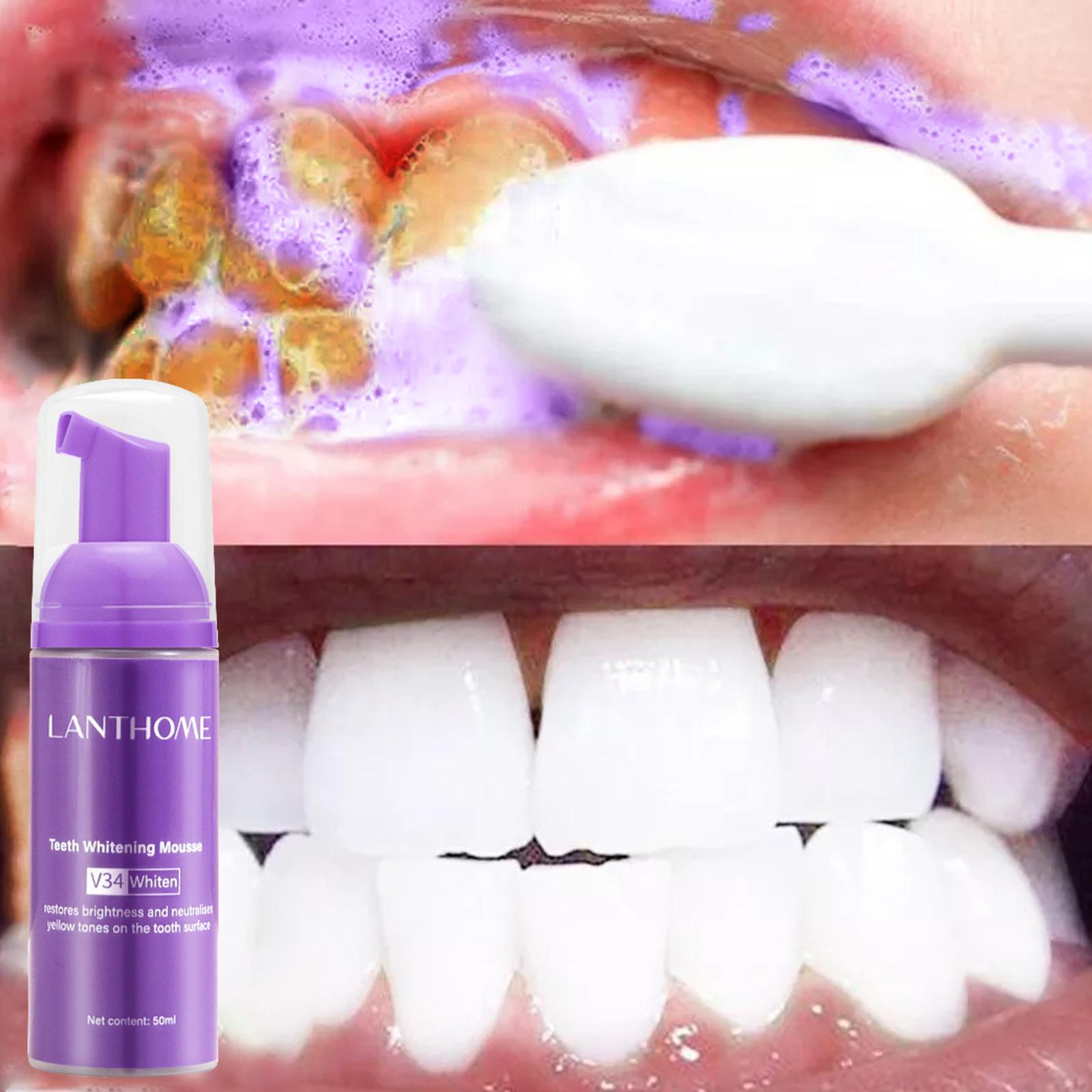 V34 Mousse Teeth Cleaning Toot - Teeth Whitening Crest recensie en prijs