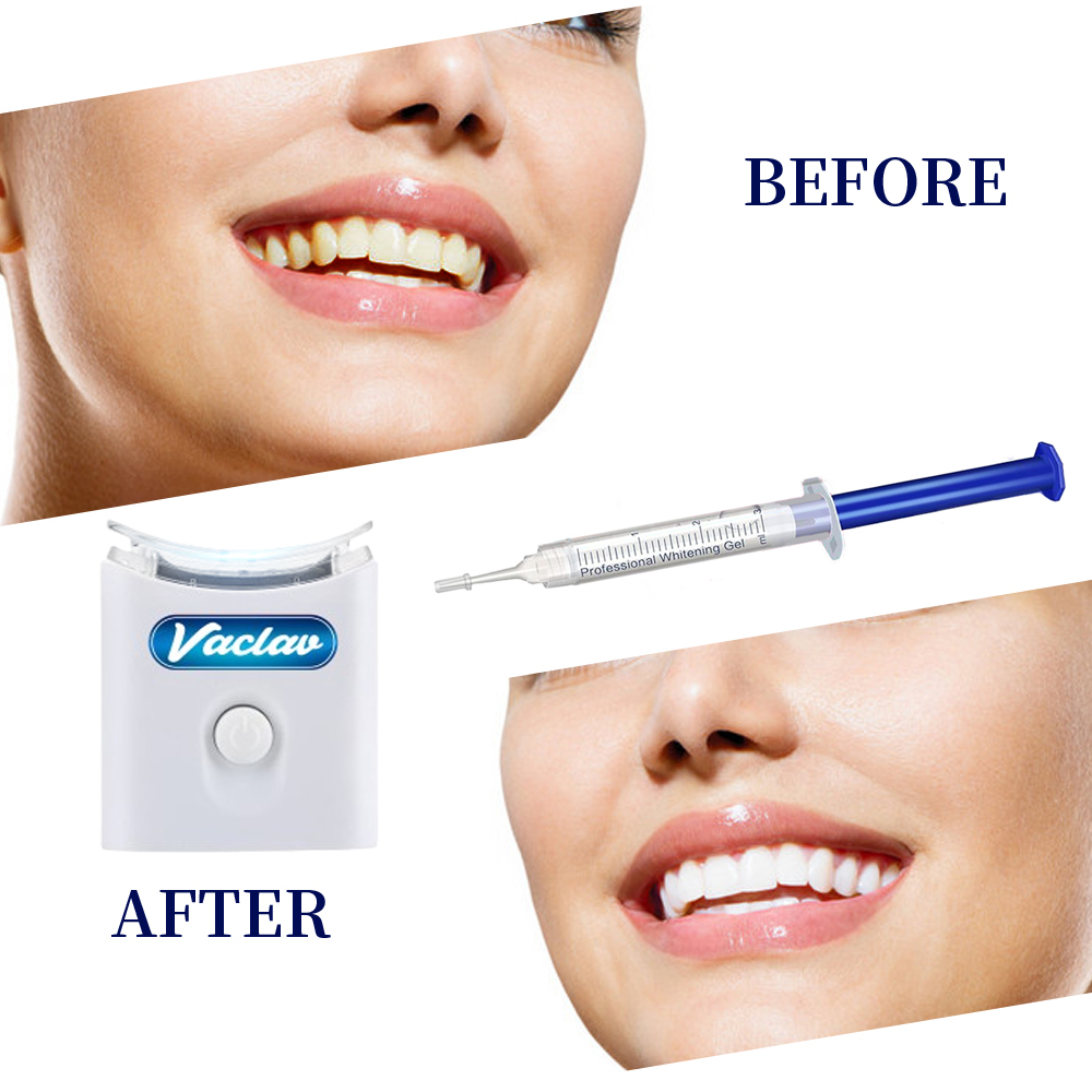 Mint Teeth Whitening Gel Syrin - Teeth Whitening Opalescence recensie en prijs