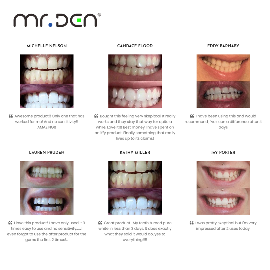 Dr. Whiten 3 Pack Teeth Whiten - Teeth Whitening Kit With Light recensie en prijs