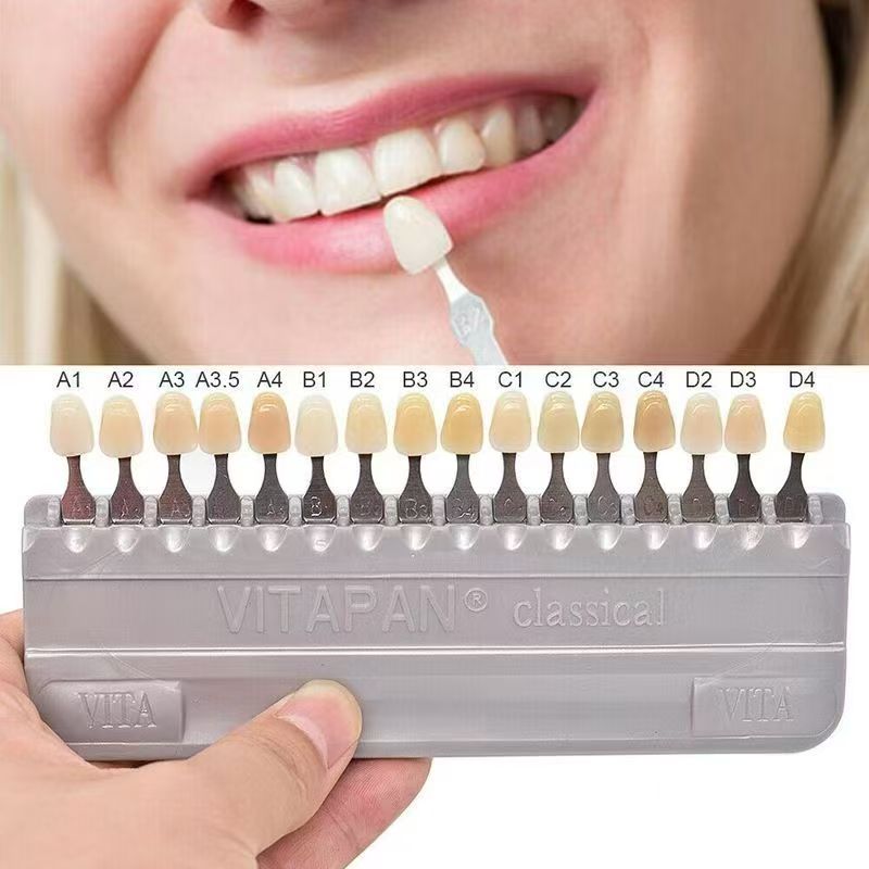 VITA 16 Colors Teeth Shade Gui - Whitening Teeth Dentist recensie en prijs