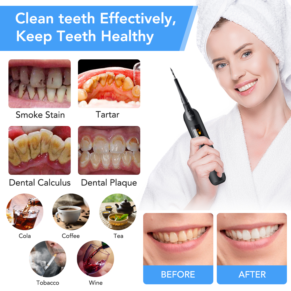 Teeth Tartar Remover Electric  - Teeth Whitening Kit With Light recensie en prijs