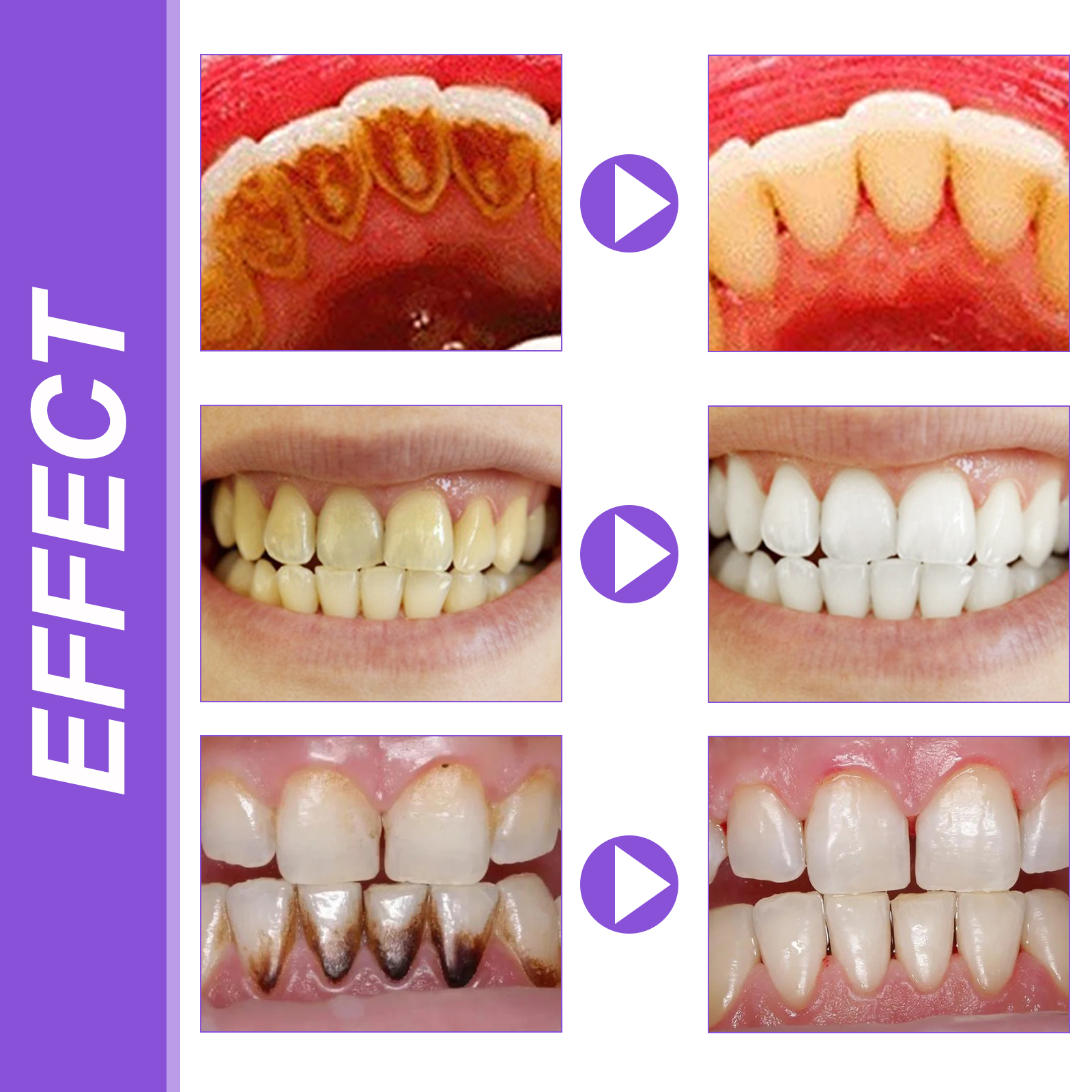 EELHOE Smiles Bright White Ref - Teeth Whitening Ingredients recensie en prijs