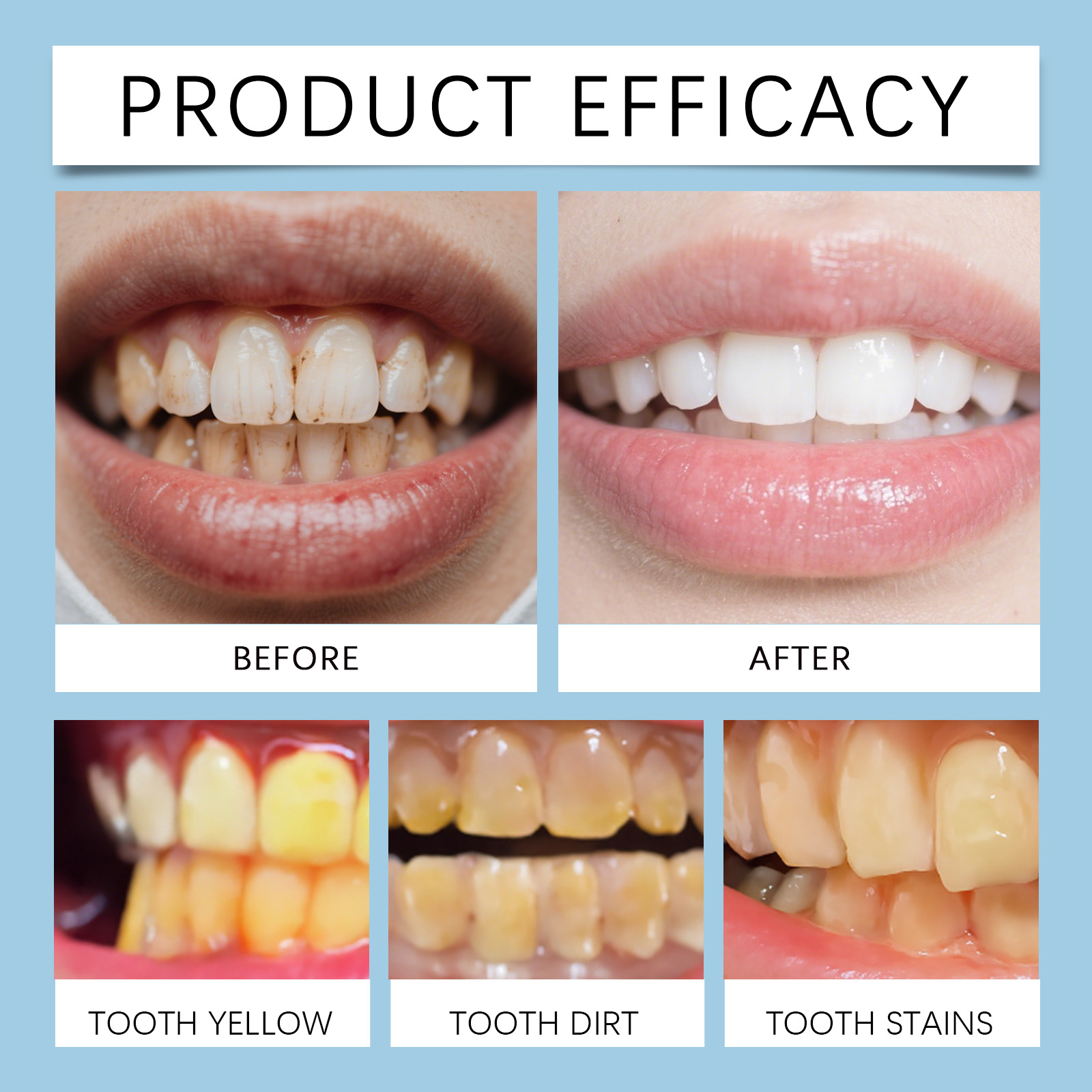 Feimuko 8ml Teeth Gel Pen Gent - Teeth Whitening Hismile recensie en prijs