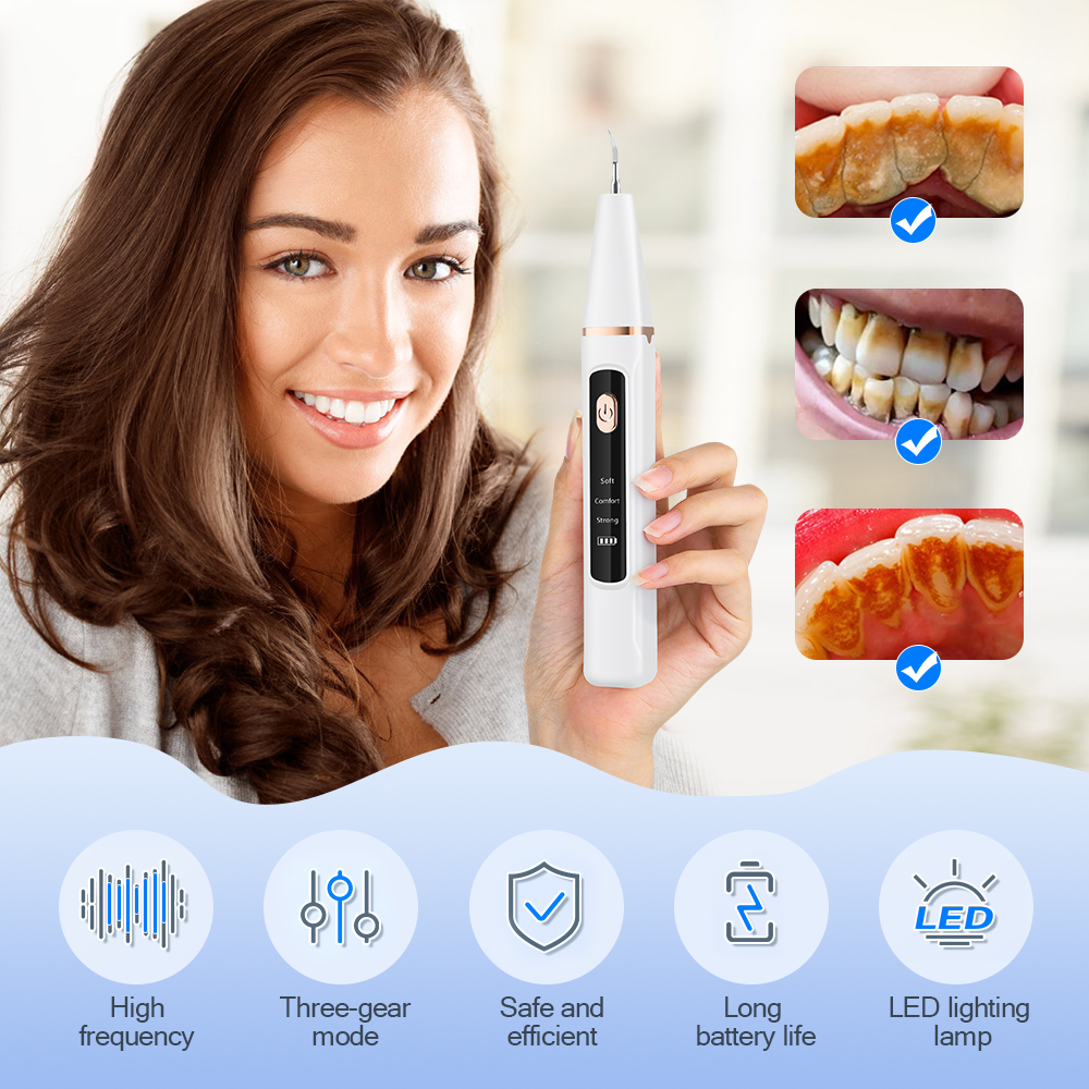 Ultrasonic Teeth Tartar Cleane - Teeth Whitening And Stain Removal recensie en prijs