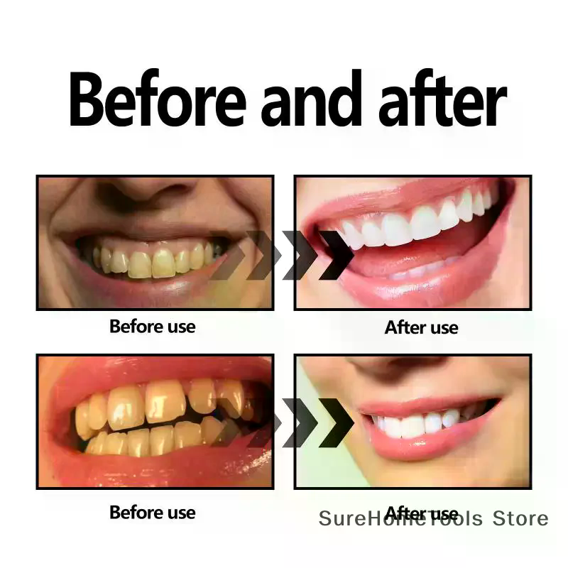 Bamboo Charcoal Powder For Tee - Teeth Whitening Hismile recensie en prijs