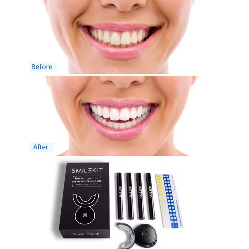 Wholesale Approved Private log - Teeth Whitening Kit With Light recensie en prijs