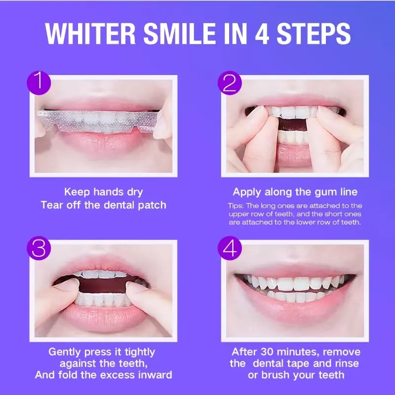 Teeth Whitening Kit - 5X LED L - Teeth Whitening Kit With Light recensie en prijs