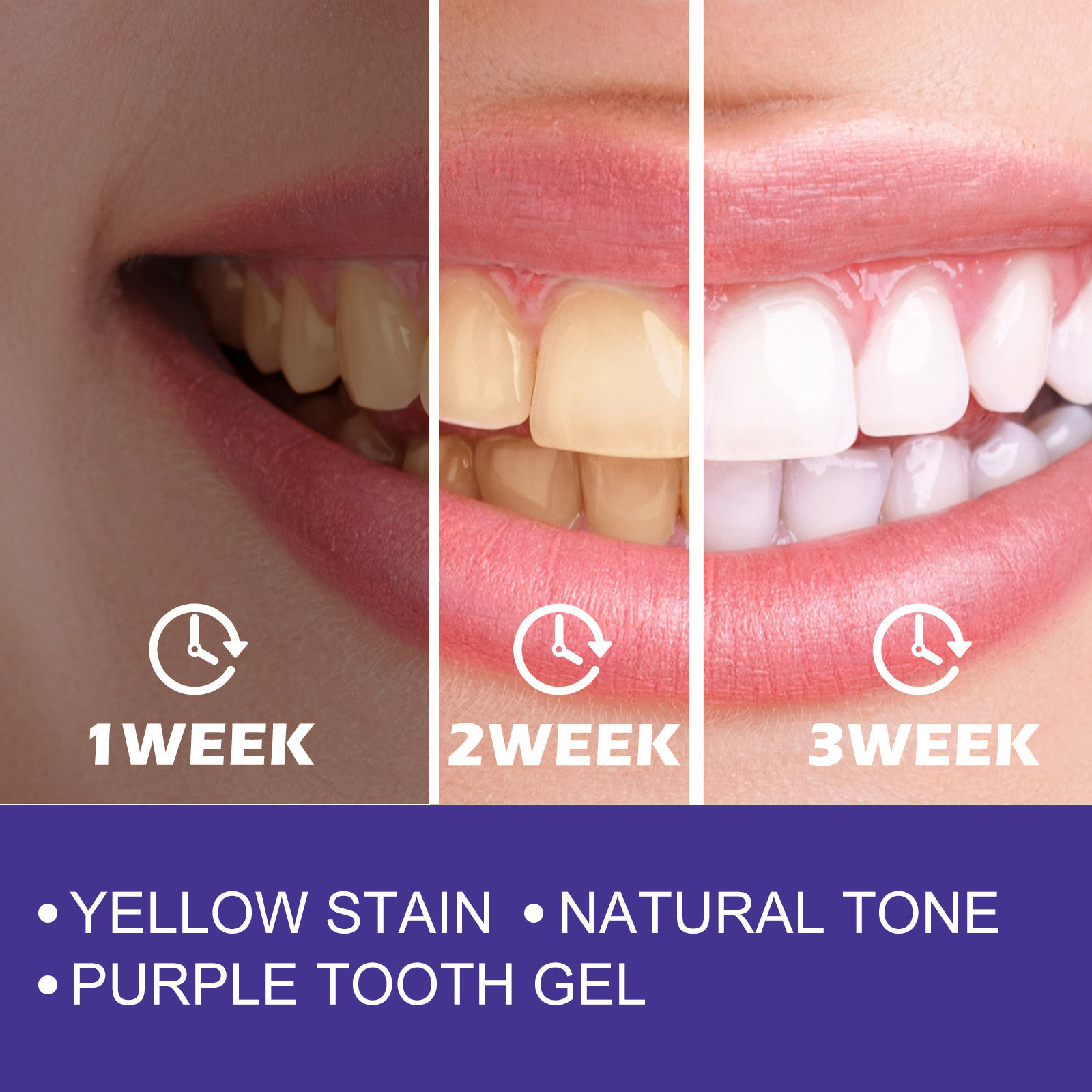 Purple Toothpaste Teeth Whiten - Teeth Whitening Crest recensie en prijs