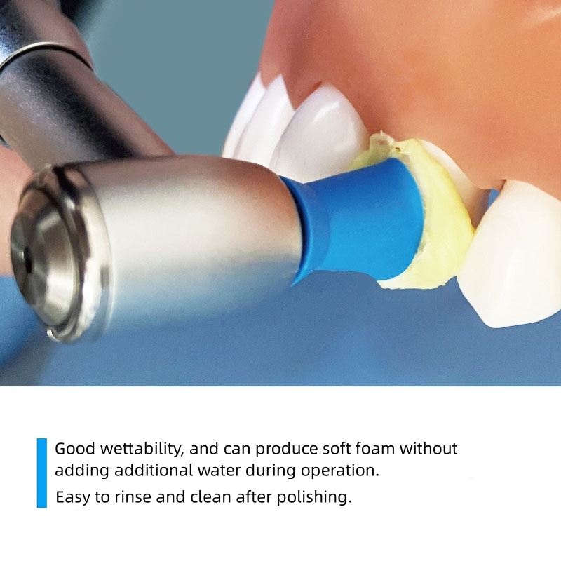 40g/Tube Dental Tooth Polishin - Whitening Teeth Dentist recensie en prijs