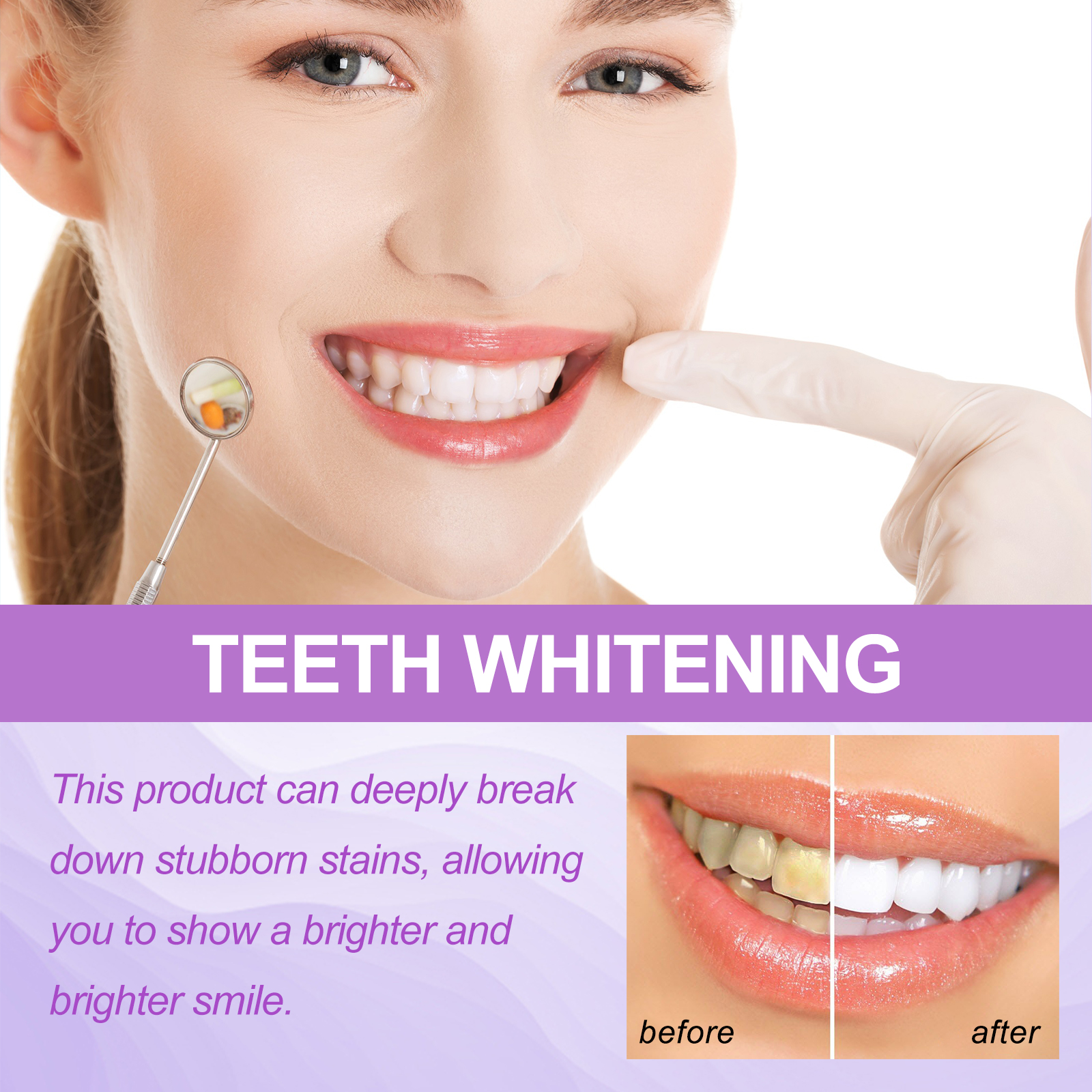 Purple Teeth Whitening Strips  - Teeth Whitening In Office recensie en prijs