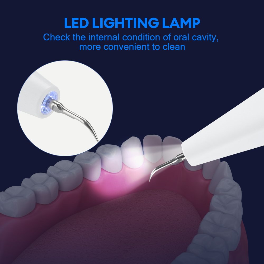 Ultrasonic Dental Calculus Rem - Whitening Teeth Dentist recensie en prijs