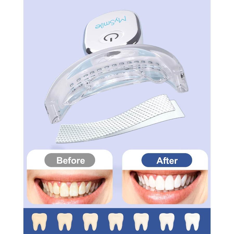 Teeth Whitening Strips Kit wit - Teeth Whitening Kit With Light recensie en prijs