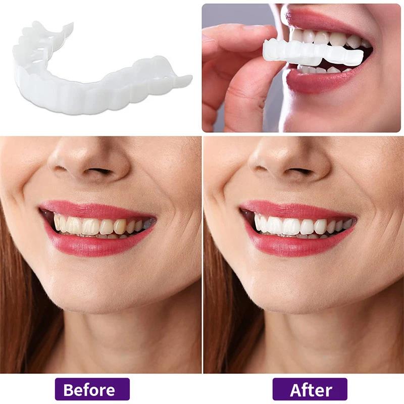 New Color Matching Natural Tee - Teeth Whitening Options recensie en prijs