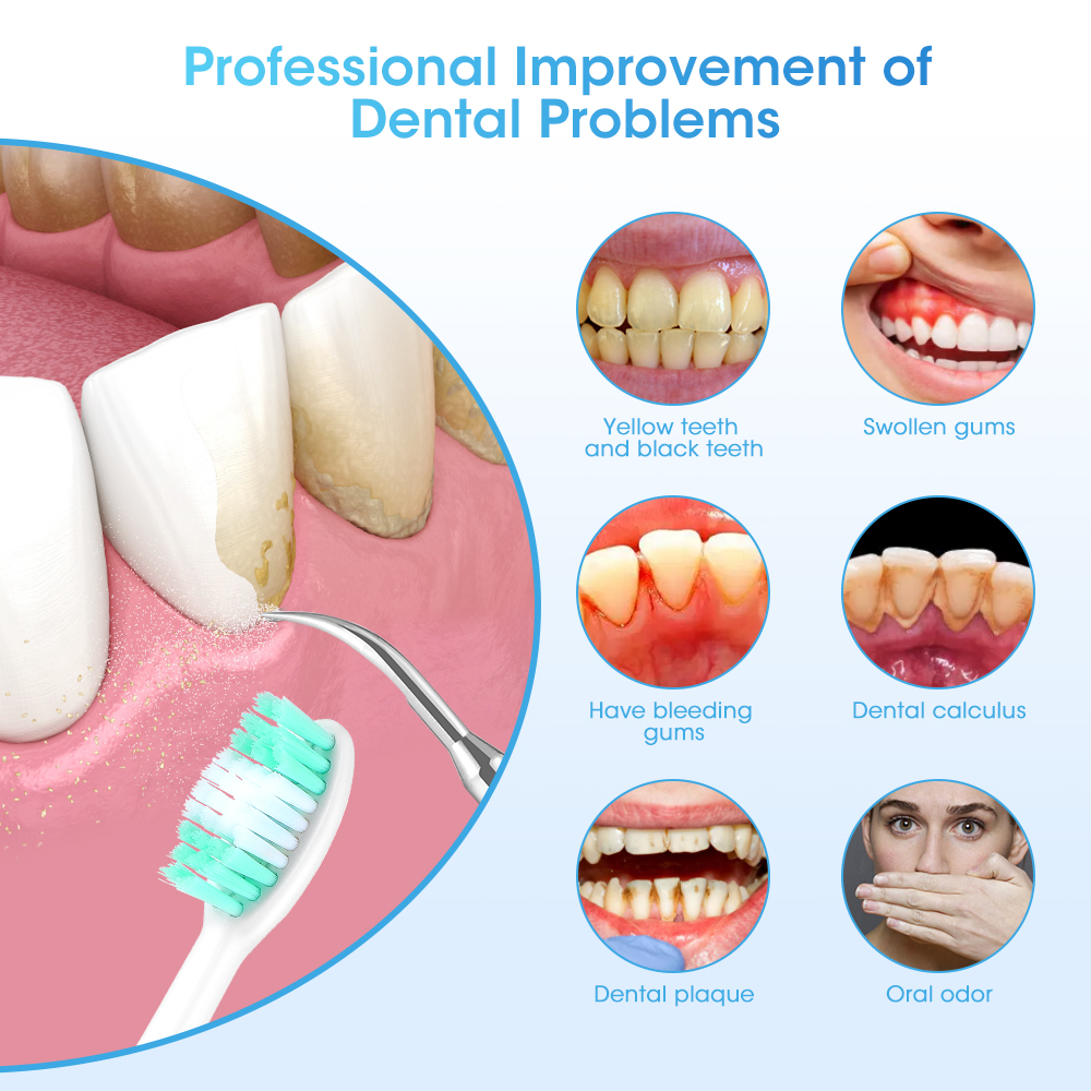 Electric Sonic Dental Calculus - Teeth Whitening And Stain Removal recensie en prijs