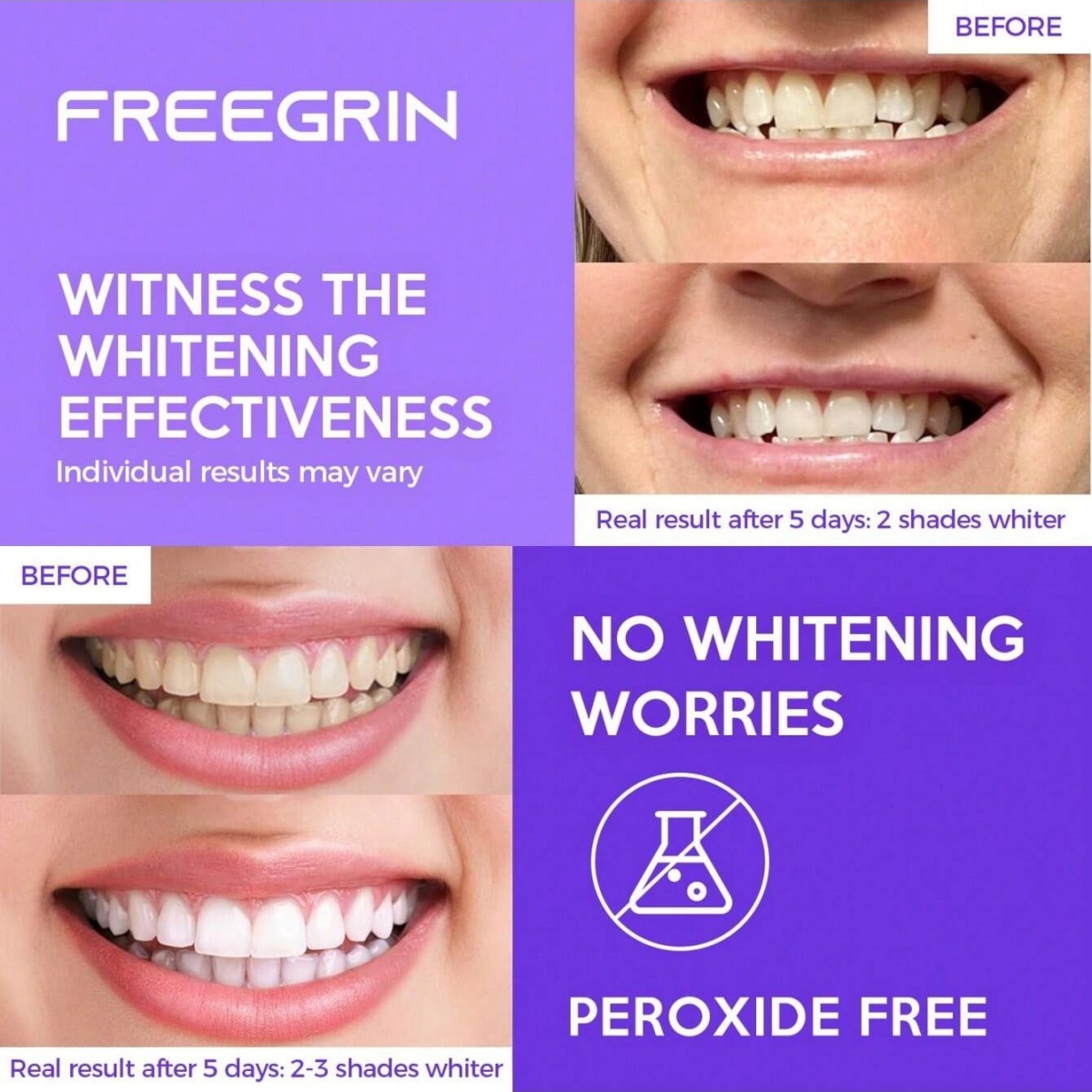 Deluxe Whitening Teeth Sticker - Teeth Whitening In Office recensie en prijs