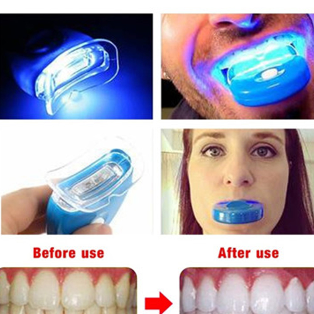 New Blue Led Teeth Whitening A - Teeth Whitening In Office recensie en prijs