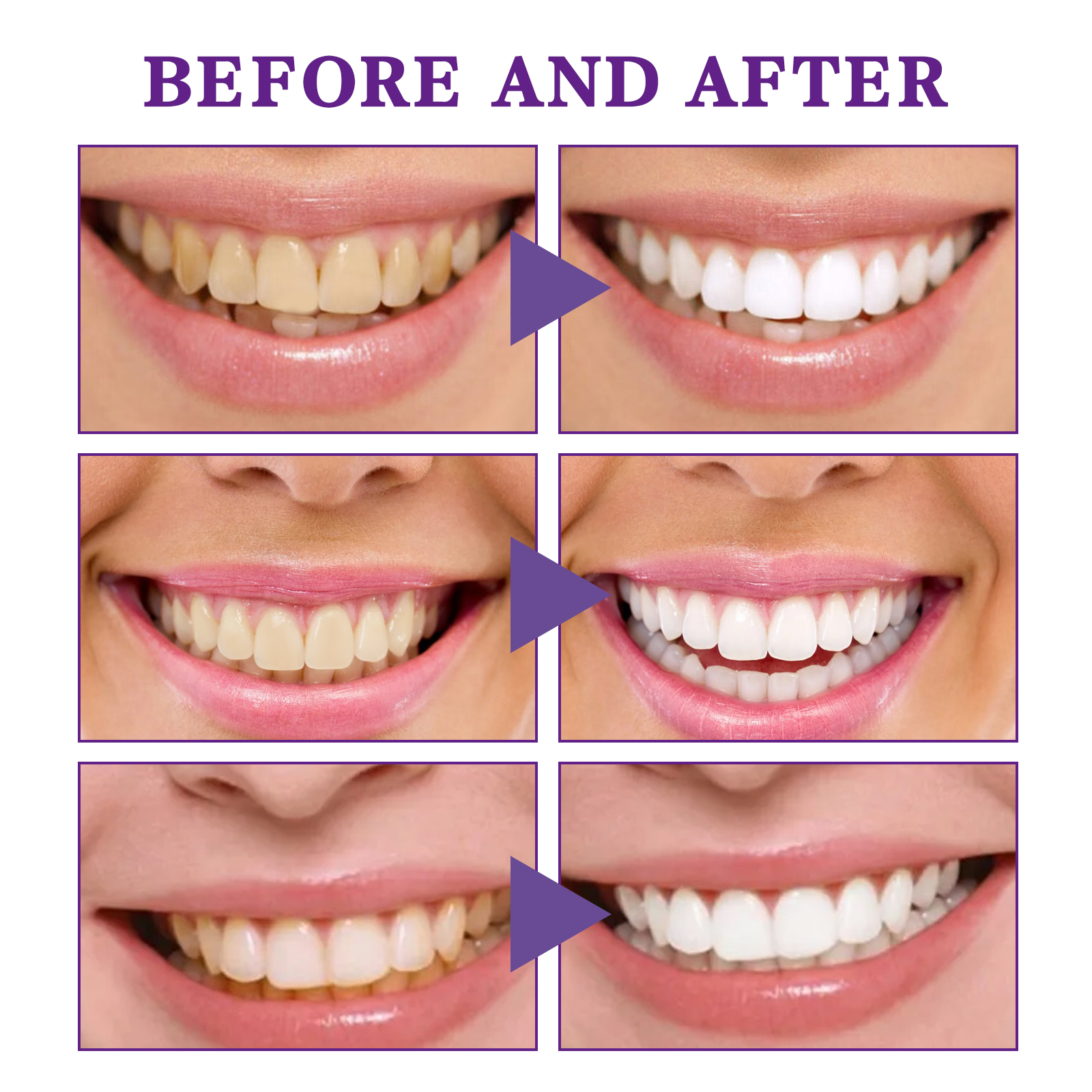 V34 Cleansing Mousse, Intensiv - Teeth Whitening Crest recensie en prijs