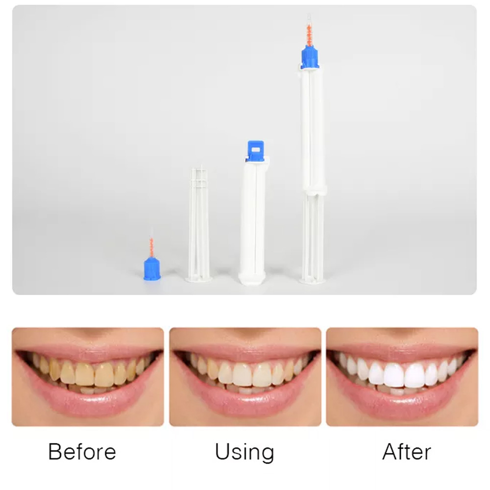 10 /5/2pcs Dental Dual Barrel  - Teeth Whitening Opalescence recensie en prijs