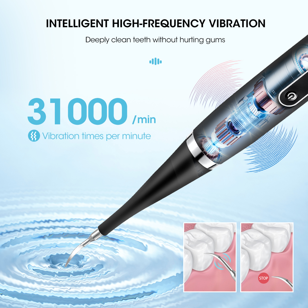 Portable Electric Sonic Dental - Teeth Whitening And Stain Removal recensie en prijs