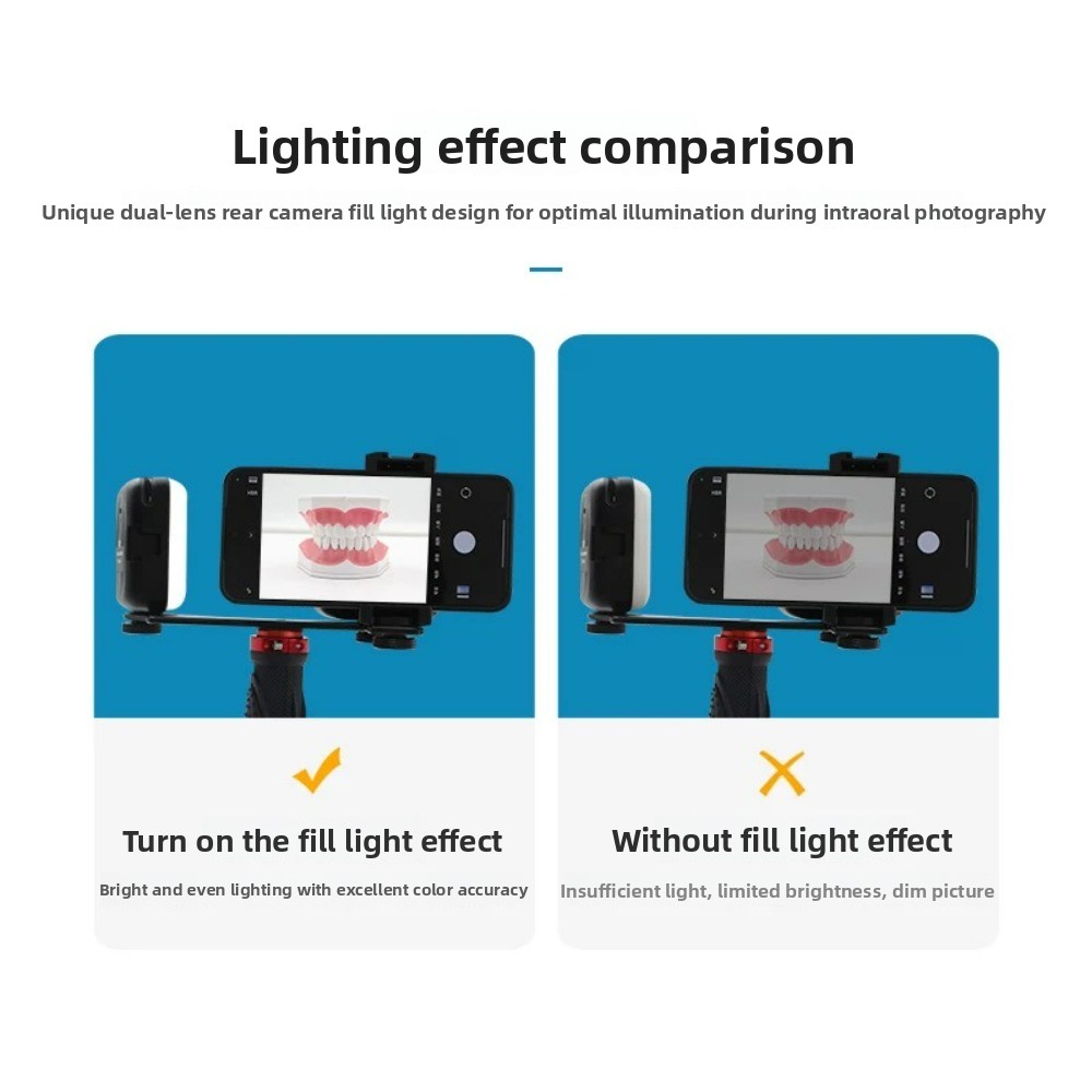 Dental Photography Light, Blue - Teeth Whitening Kit With Light recensie en prijs