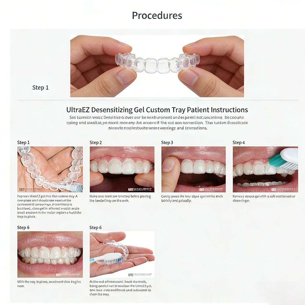 Ultra Ez Dental Desensitizing  - Teeth Whitening Opalescence recensie en prijs