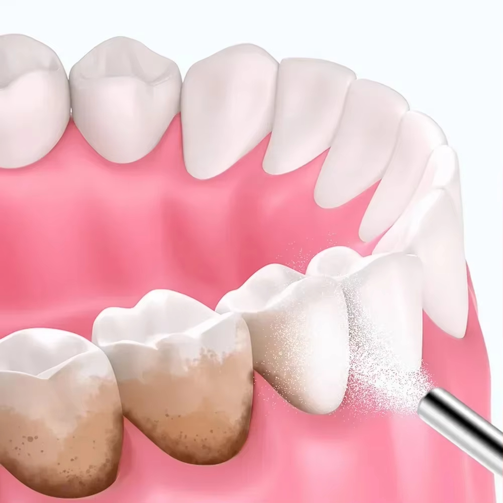 Dental Sandblasting Powder 500 - Teeth Whitening Ingredients recensie en prijs