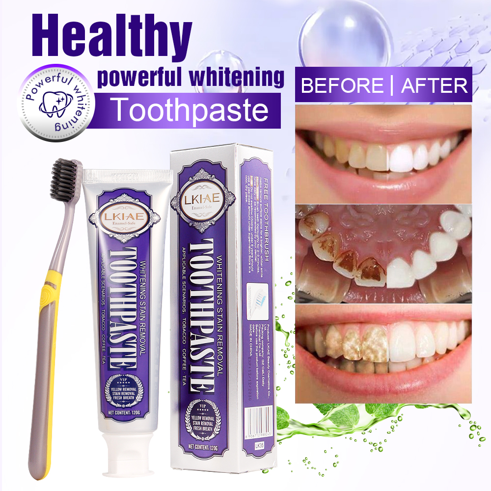 LKIAE White Teeth Whitening To - Teeth Whitening And Stain Removal recensie en prijs