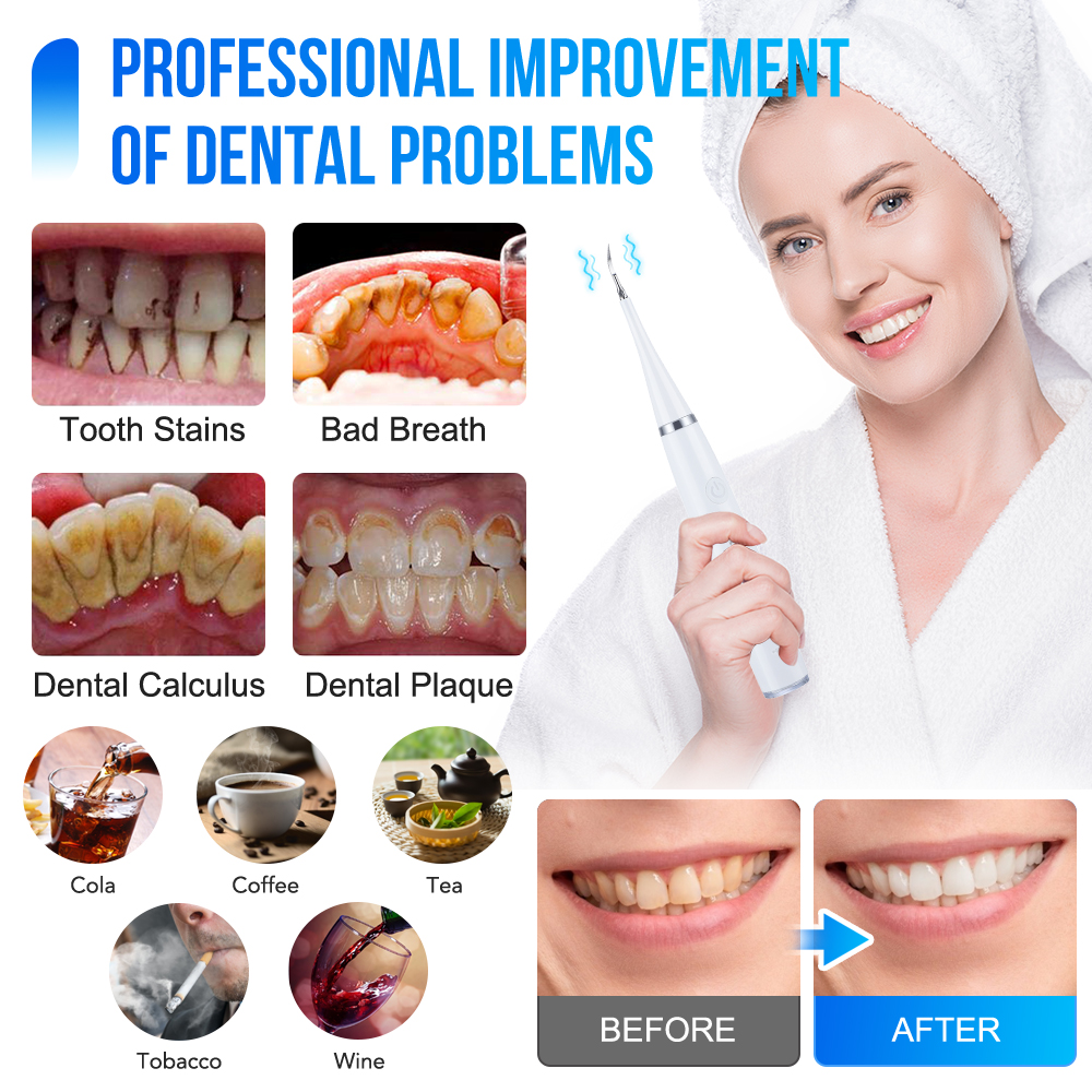 Household Electric Teeth Clean - Teeth Whitening And Stain Removal recensie en prijs