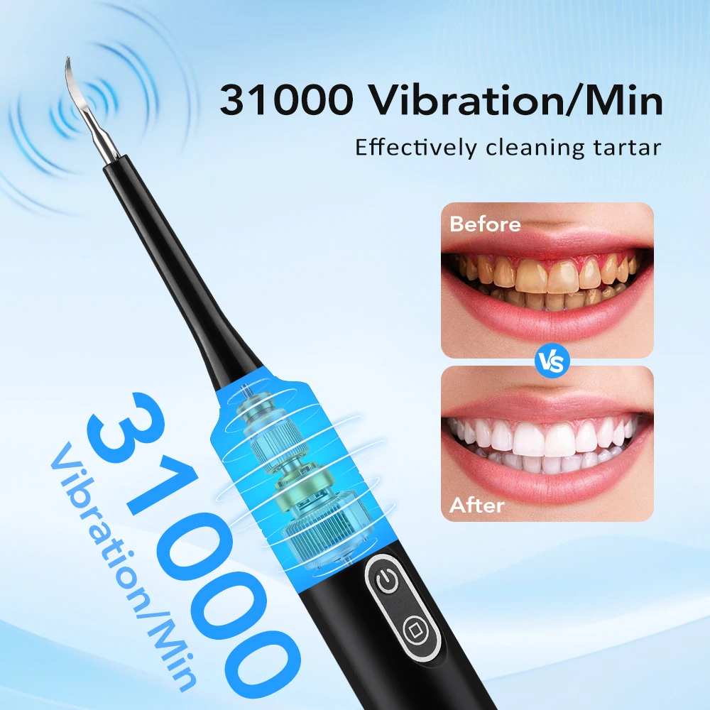 Electric Sonic Vibration Denta - Teeth Whitening And Stain Removal recensie en prijs