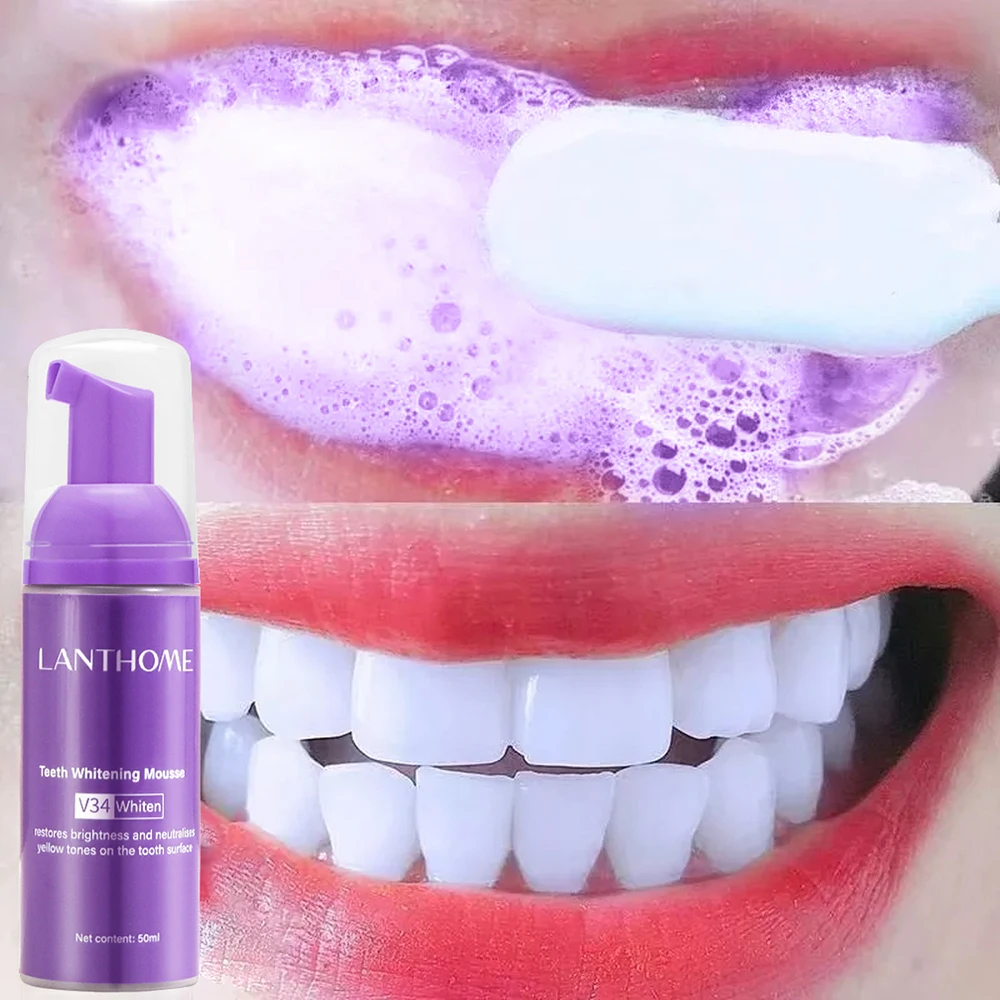 Mousse V34 Toothpaste Teeth Cl - Teeth Whitening Crest recensie en prijs