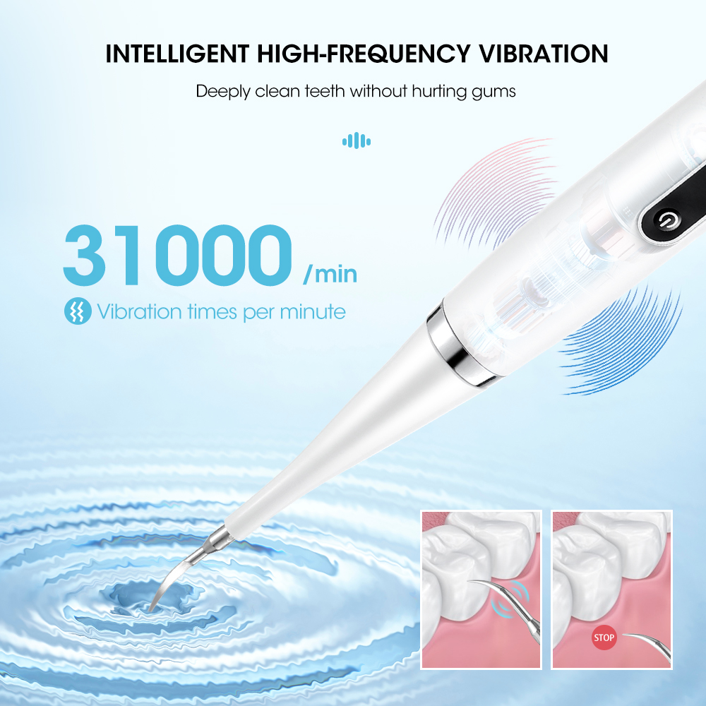 Electric Sonic Dental Calculus - Teeth Whitening And Stain Removal recensie en prijs