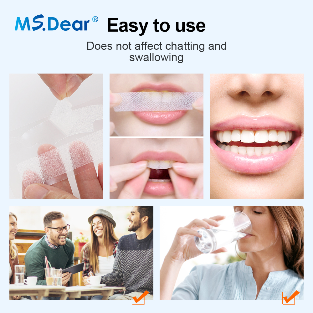 Teeth Whitening Strips Cleansi - Teeth Whitening Hismile recensie en prijs